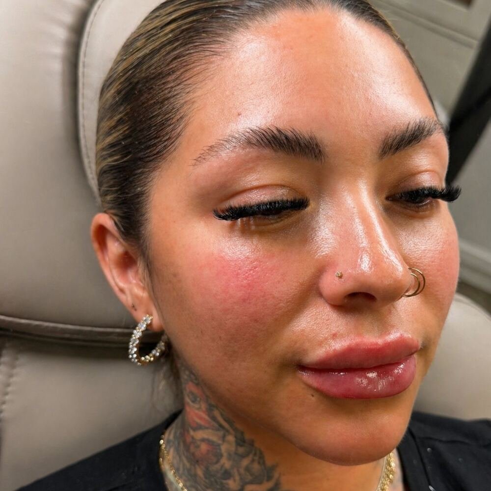 Injectables
